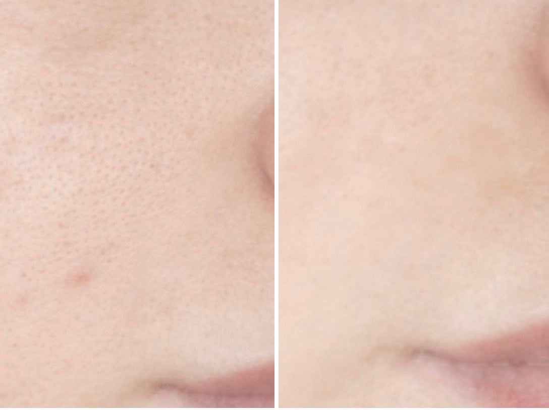 Nila Face Brightening Ritual
