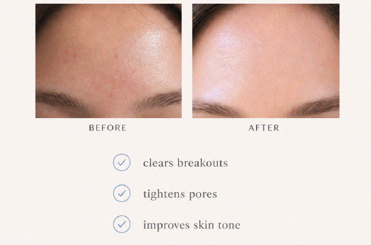 Nila Brightening Face Ritual with Glycolic Acid + Exfoliating Soap Pouch